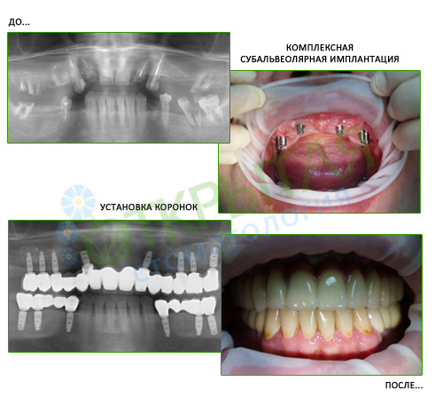 Работа врачей Открытой стоматологии