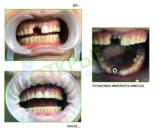 Работа врачей Открытой стоматологии